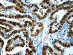 S100A13 Antibody in Immunohistochemistry (Paraffin) (IHC (P))