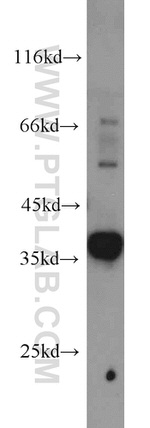 Syntaxin 4 Antibody in Western Blot (WB)