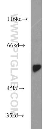 DARS Antibody in Western Blot (WB)