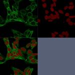 Catenin, beta (p120) Antibody in Immunocytochemistry (ICC/IF)