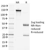 Catenin, beta (p120) Antibody in SDS-PAGE (SDS-PAGE)