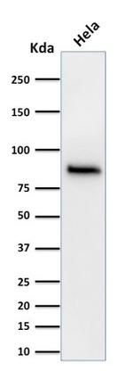 Catenin, beta (p120) Antibody in Western Blot (WB)