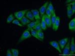 RPL39 Antibody in Immunocytochemistry (ICC/IF)