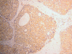 RPL39 Antibody in Immunohistochemistry (Paraffin) (IHC (P))