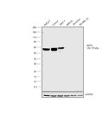 Cytokeratin 8 Antibody in Western Blot (WB)