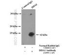 DDA1 Antibody in Immunoprecipitation (IP)