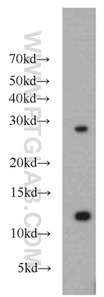 DDA1 Antibody in Western Blot (WB)