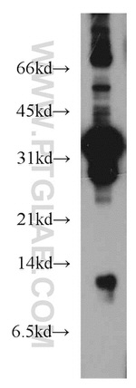 DDA1 Antibody in Western Blot (WB)