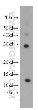 DDA1 Antibody in Western Blot (WB)