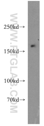 ABCB6 Antibody in Western Blot (WB)