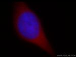 PDCL3 Antibody in Immunocytochemistry (ICC/IF)