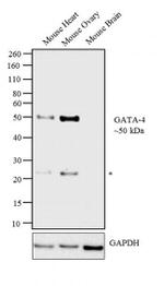 Gata-4 Antibody in Western Blot (WB)