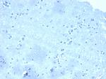 p120/Catenin, delta-1 (CTNND1) Antibody in Immunohistochemistry (Paraffin) (IHC (P))