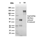 p120/Catenin delta-1 (CTNND1) Antibody in Immunoelectrophoresis (IE)