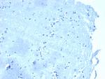 p120/Catenin, delta-1 (CTNND1) Antibody in Immunohistochemistry (Paraffin) (IHC (P))