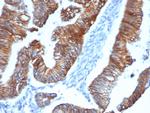 p120/Catenin, delta-1 (CTNND1) Antibody in Immunohistochemistry (Paraffin) (IHC (P))