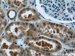 TCTN1 Antibody in Immunohistochemistry (Paraffin) (IHC (P))