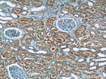 TCTN1 Antibody in Immunohistochemistry (Paraffin) (IHC (P))