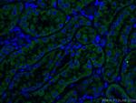 TCTN1 Antibody in Immunohistochemistry (PFA fixed) (IHC (PFA))