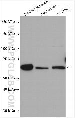 TCTN1 Antibody in Western Blot (WB)