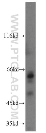 TCTN1 Antibody in Western Blot (WB)