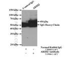 ARIH2 Antibody in Immunoprecipitation (IP)