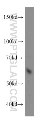 ARIH2 Antibody in Western Blot (WB)