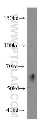 ARIH2 Antibody in Western Blot (WB)