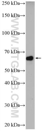 ENC1 Antibody in Western Blot (WB)