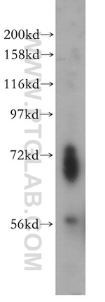 ENC1 Antibody in Western Blot (WB)