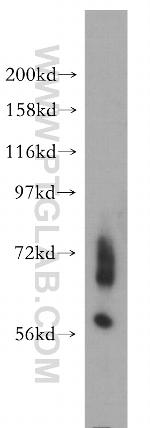 ENC1 Antibody in Western Blot (WB)