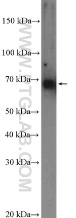 ENC1 Antibody in Western Blot (WB)