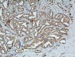 SKP2 Antibody in Immunohistochemistry (Paraffin) (IHC (P))