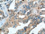 SKP2 Antibody in Immunohistochemistry (Paraffin) (IHC (P))