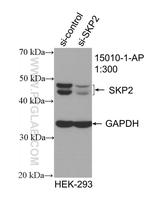 SKP2 Antibody in Western Blot (WB)