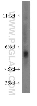 Cathepsin A Antibody in Western Blot (WB)