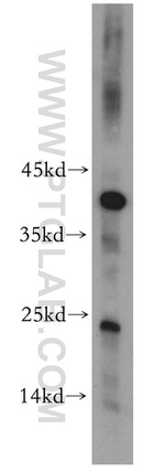 CITED2 Antibody in Western Blot (WB)