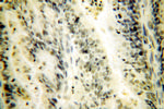 CPSF4 Antibody in Immunohistochemistry (Paraffin) (IHC (P))