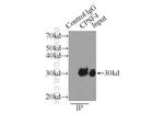 CPSF4 Antibody in Immunoprecipitation (IP)