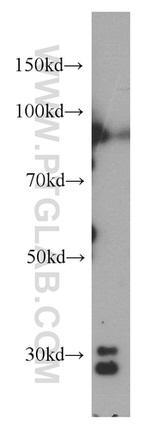 CPSF4 Antibody in Western Blot (WB)