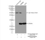 RAB3A Antibody in Immunoprecipitation (IP)