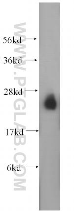 RAB3A Antibody in Western Blot (WB)