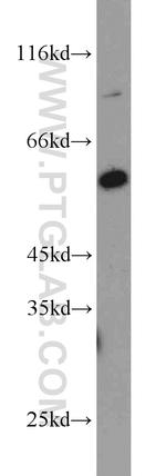 PHF17 Antibody in Western Blot (WB)