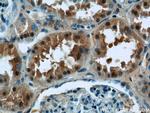 OSGEP Antibody in Immunohistochemistry (Paraffin) (IHC (P))