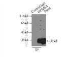 GPM6A Antibody in Immunoprecipitation (IP)