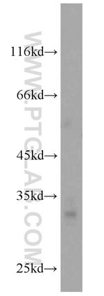 GPM6A Antibody in Western Blot (WB)