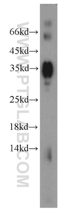 GPM6A Antibody in Western Blot (WB)