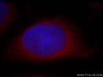 POMP Antibody in Immunocytochemistry (ICC/IF)