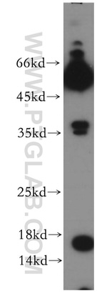 POMP Antibody in Western Blot (WB)