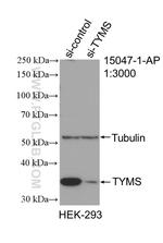 Thymidylate synthase Antibody in Western Blot (WB)